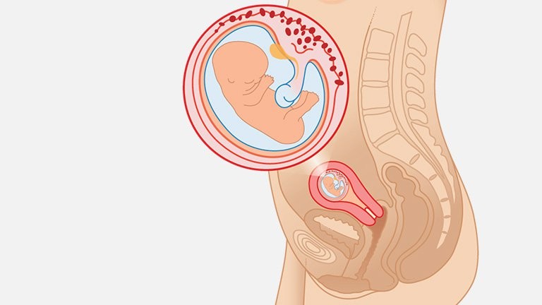Mang thai tuần 10 có gì đặc biệt mà mẹ chưa biết?